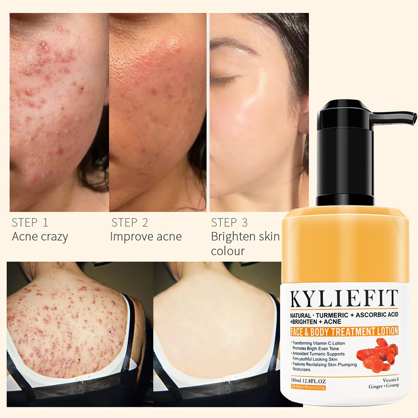 AILKE Firming and Brightening Lotion for Uneven Skin Tone